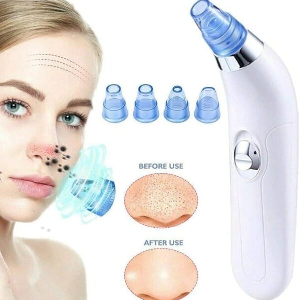 جهاز ازالة الرؤوس السوداء والزوان وتفريغ المسام بالشفط، جهاز كهربائي لتقشير البشرة وازالة حب لشباب والرؤوس السوداء